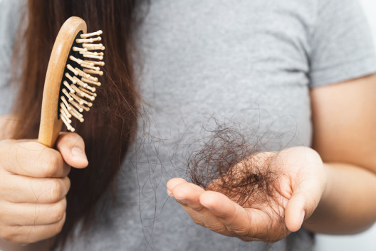 Hair Loss